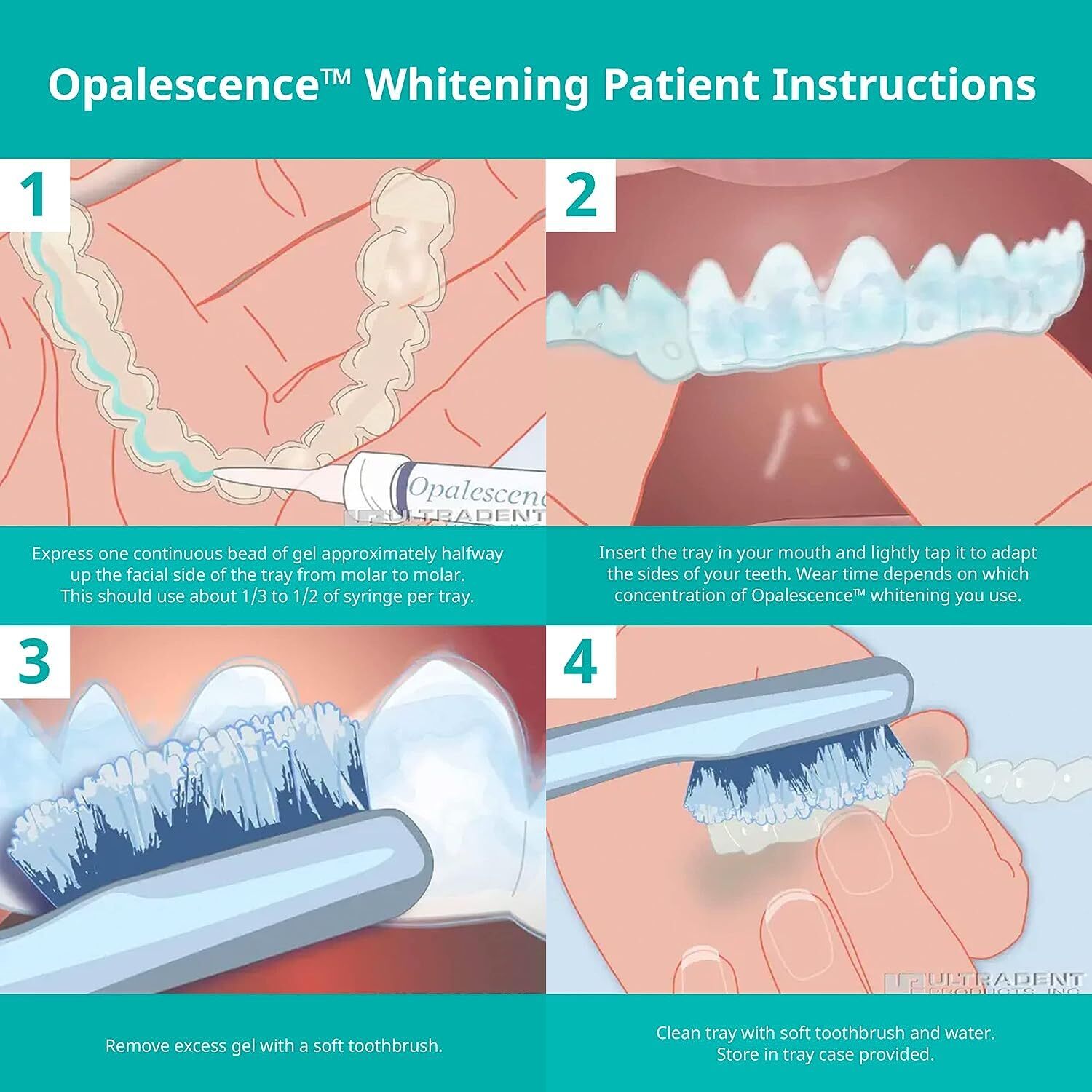  کیت بلیچینگ خانگی ۸ سرنگ الترادنت 20 درصد opalsescence home bleaching kit 